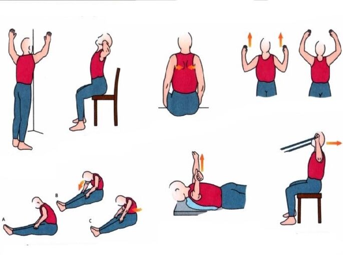 Exercices physiques dans le traitement de l'ostéochondose